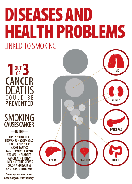 smoking-linked-to-cancer