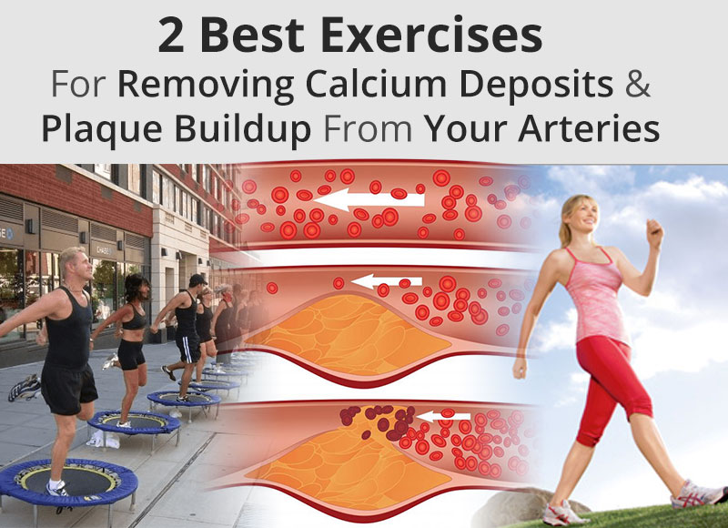 2-Best-Exercises-For-Removing-Calcium-Deposits-&-Plaque-Buildup-From-Your-Arteries-Feature