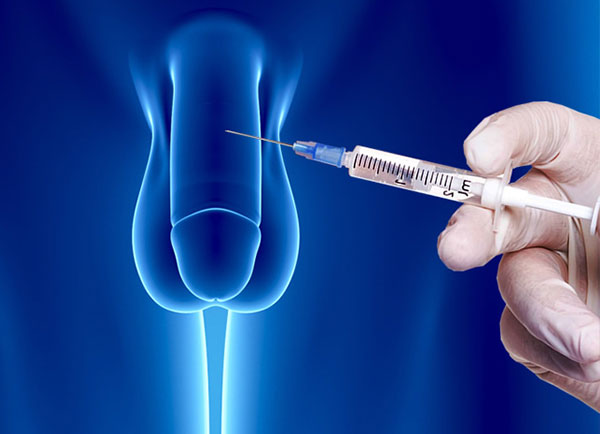 Penile-Injections