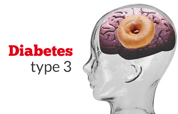 type 3 diabetes memory loss