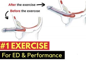 #1 Exercise For Avoiding Erectile Dysfunction & Improving Your “Performance” In The Bedroom