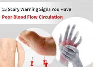 15 Scary Warning Signs You Have Poor Blood Flow Circulation That You Can’t Ignore