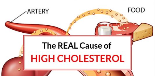 The REAL Cause of High Cholesterol