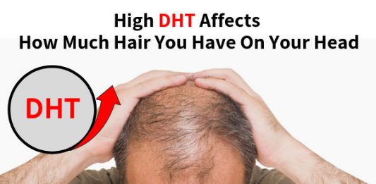 High DHT Affects How Much Hair You Have On Your Head