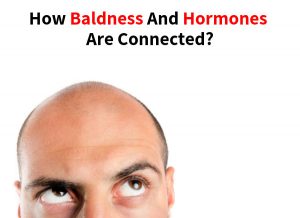 How Baldness and Hormones Are Connected
