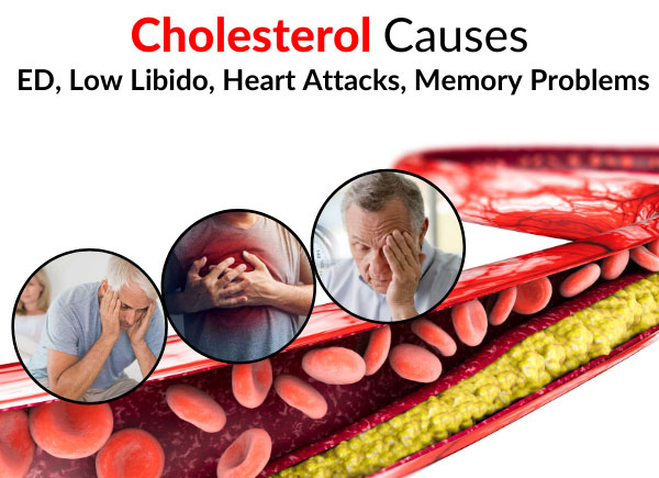 Cholesterol Causes ED, Low Libido, Heart Attacks, Memory Problems, Etc