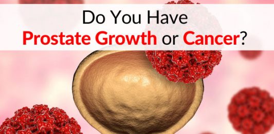Do You Have Prostate Growth or Cancer? Read this Article