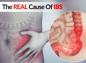 The REAL Cause Of IBS - New Research