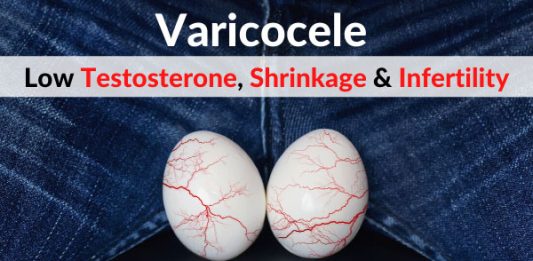 Varicocele (Scrotum Varicose Veins) - Low Testosterone, Testicular Shrinkage & Infertility