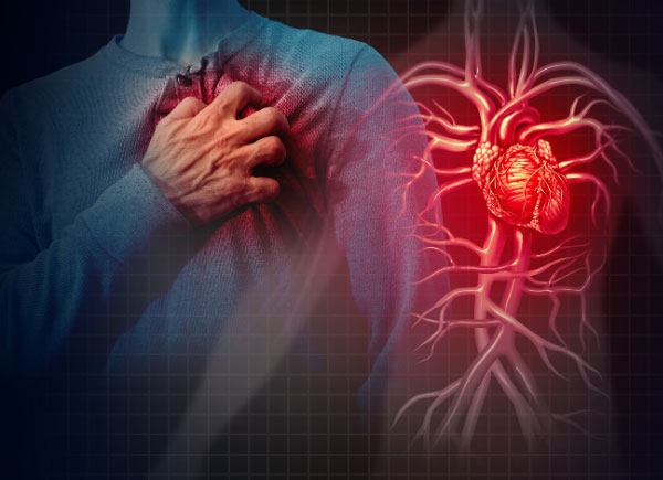 coronary artery disease heart failure