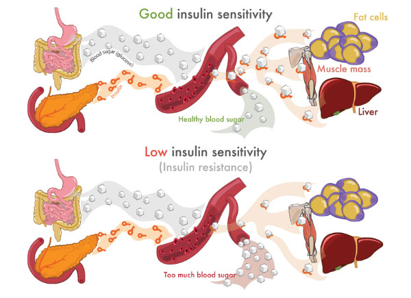 insulin sensitivity