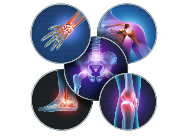 inflammation joints