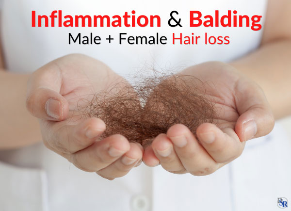 Inflammation & Balding - Male + Female Hair loss