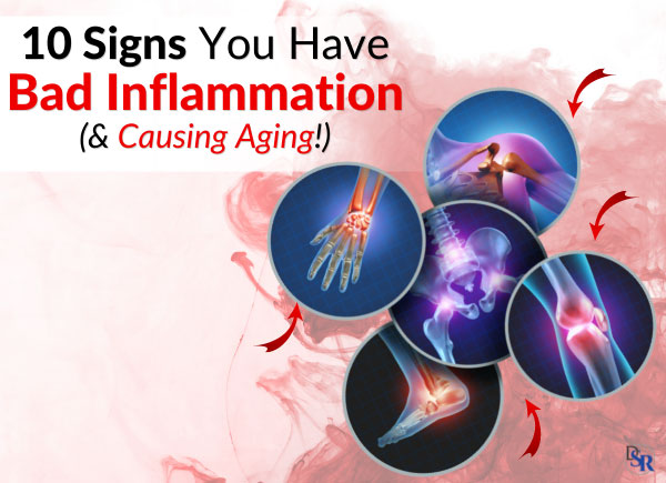 10 Signs You Have Bad Inflammation (& Causing Aging!)