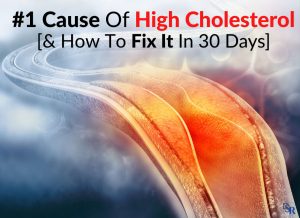 #1 Cause Of High Cholesterol [& How To Fix It In 30 Days]