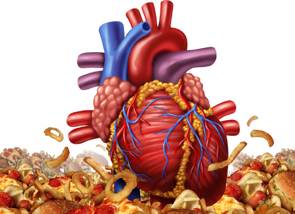 dietary cholesterol and heart disease