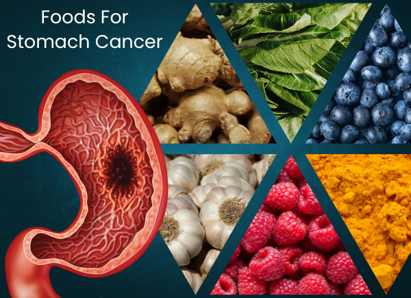 foods for stomach cancer | Dr. Sam Robbins foods for stomach cancer